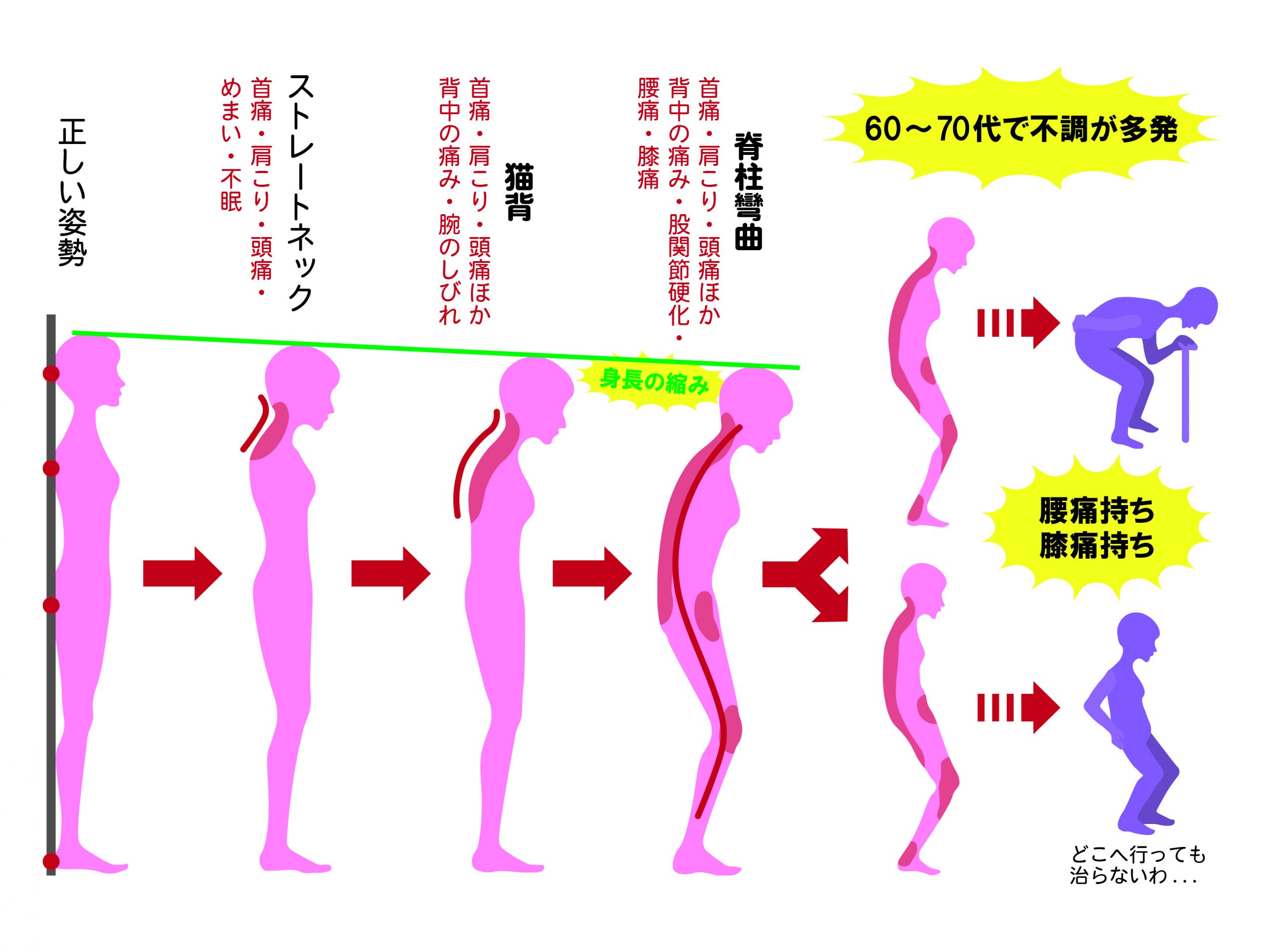 どのような症状がありますか?
