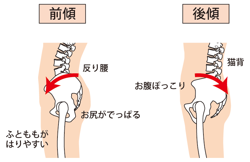 骨盤の前傾と後傾