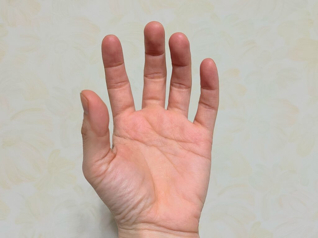 まっすぐ伸びない指